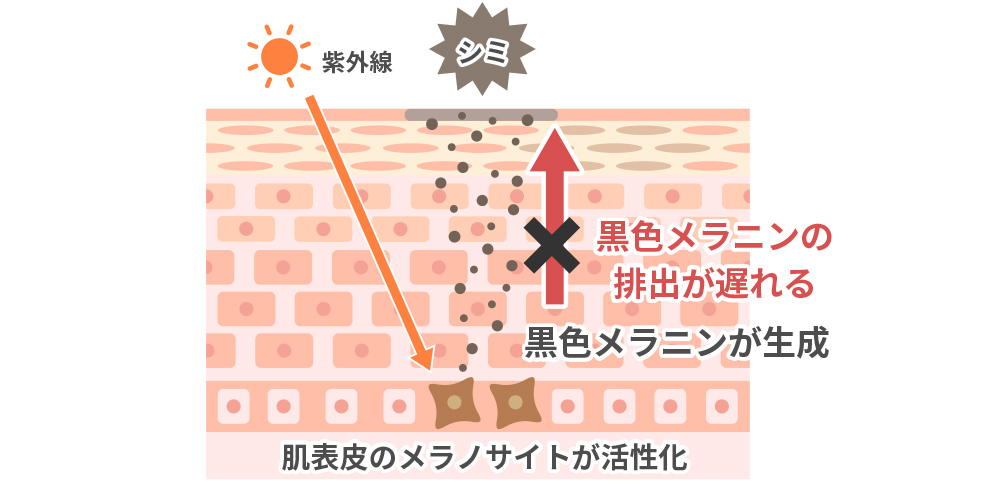 シミが出来る解説図